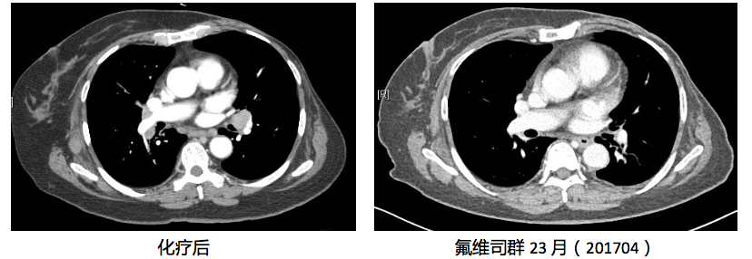 病例点评5.png