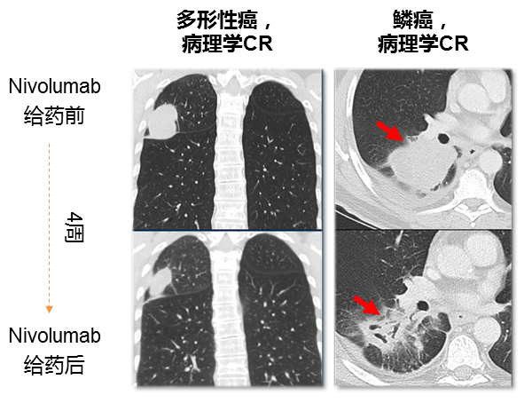 表格4.png