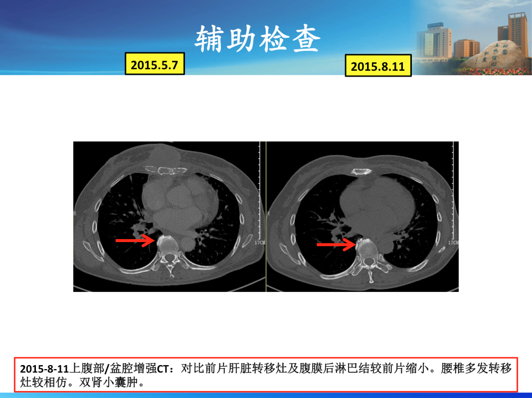 屏幕快照 2017-08-03 下午8.55.15.png