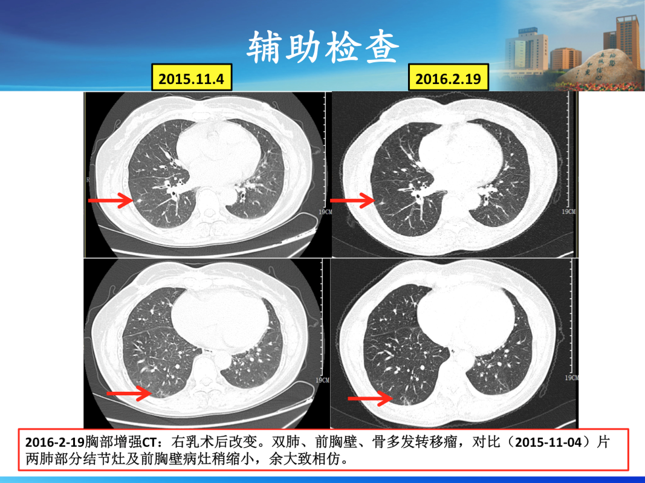 屏幕快照 2017-08-03 下午8.55.34.png