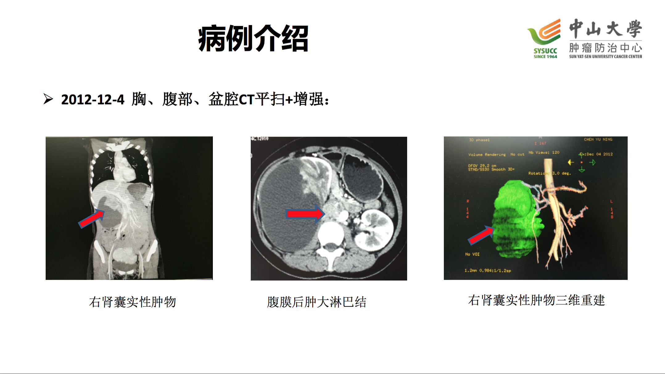 屏幕快照 2017-08-03 下午11.52.29.png