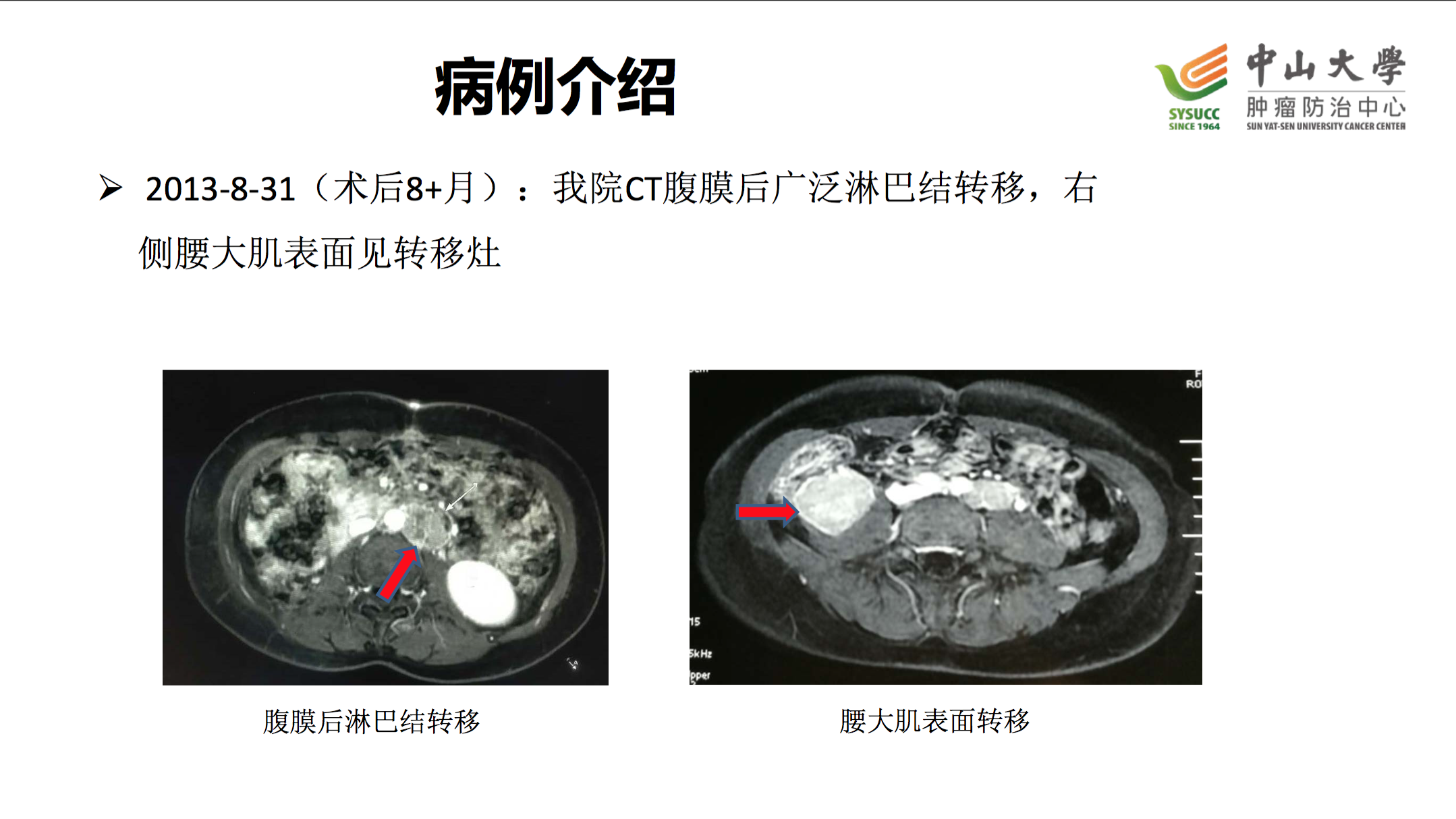 屏幕快照 2017-08-03 下午11.52.51.png