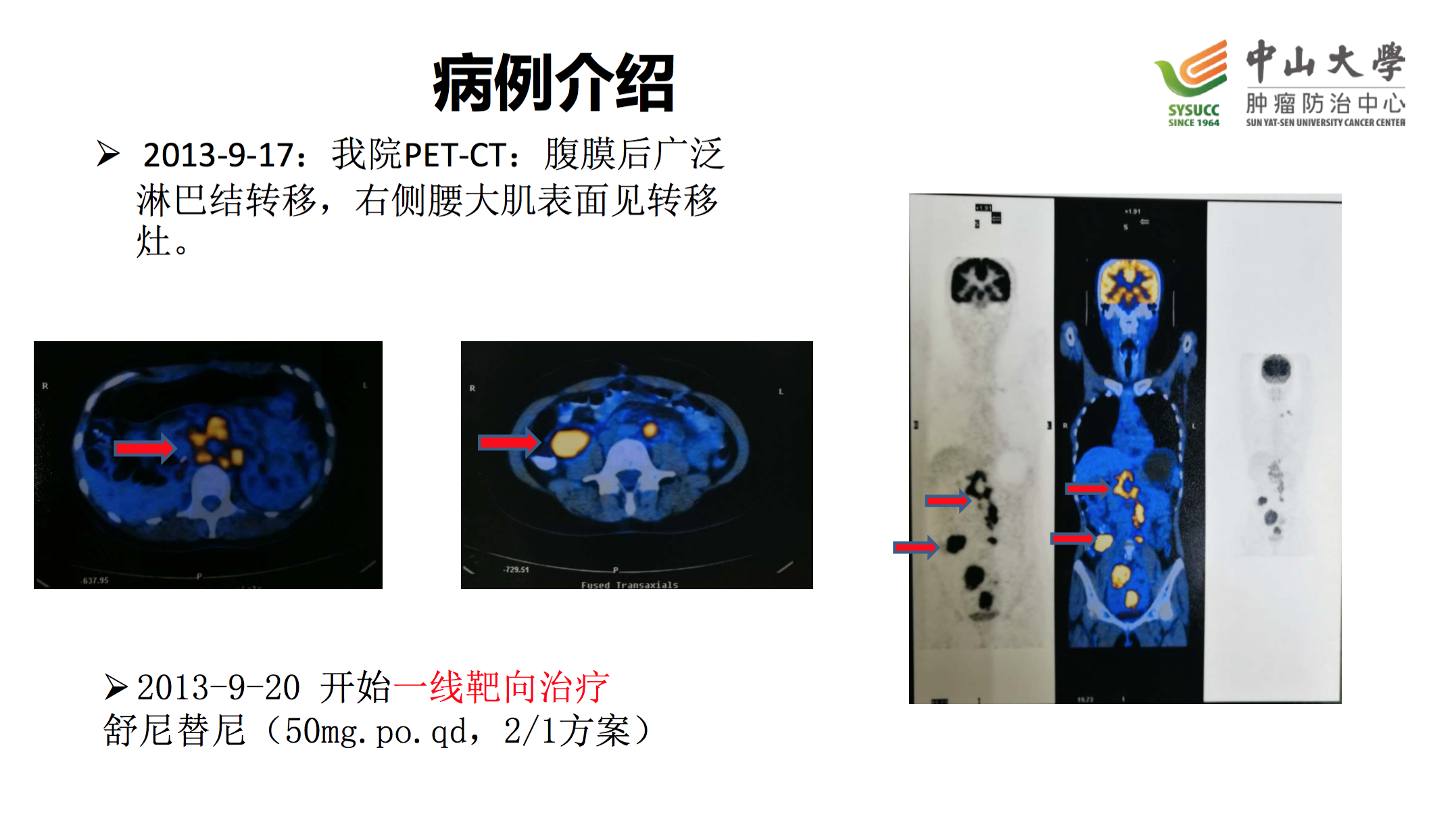 屏幕快照 2017-08-03 下午11.53.13.png