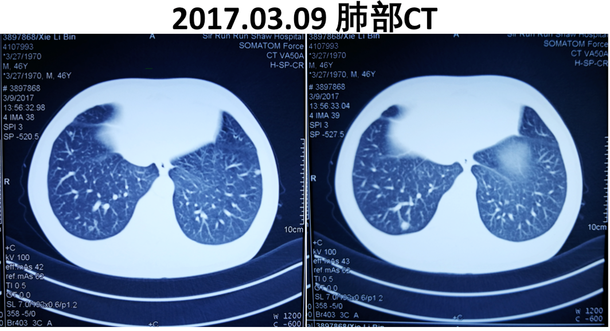 屏幕快照 2017-08-04 上午1.01.50.png