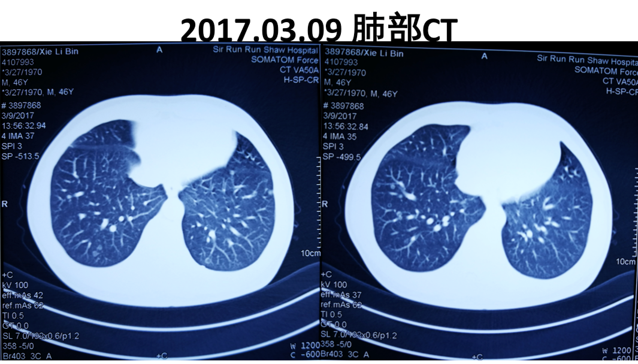 屏幕快照 2017-08-04 上午1.02.15.png