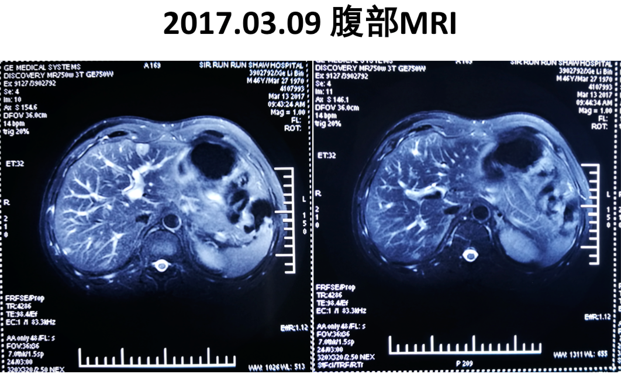 屏幕快照 2017-08-04 上午1.02.24.png
