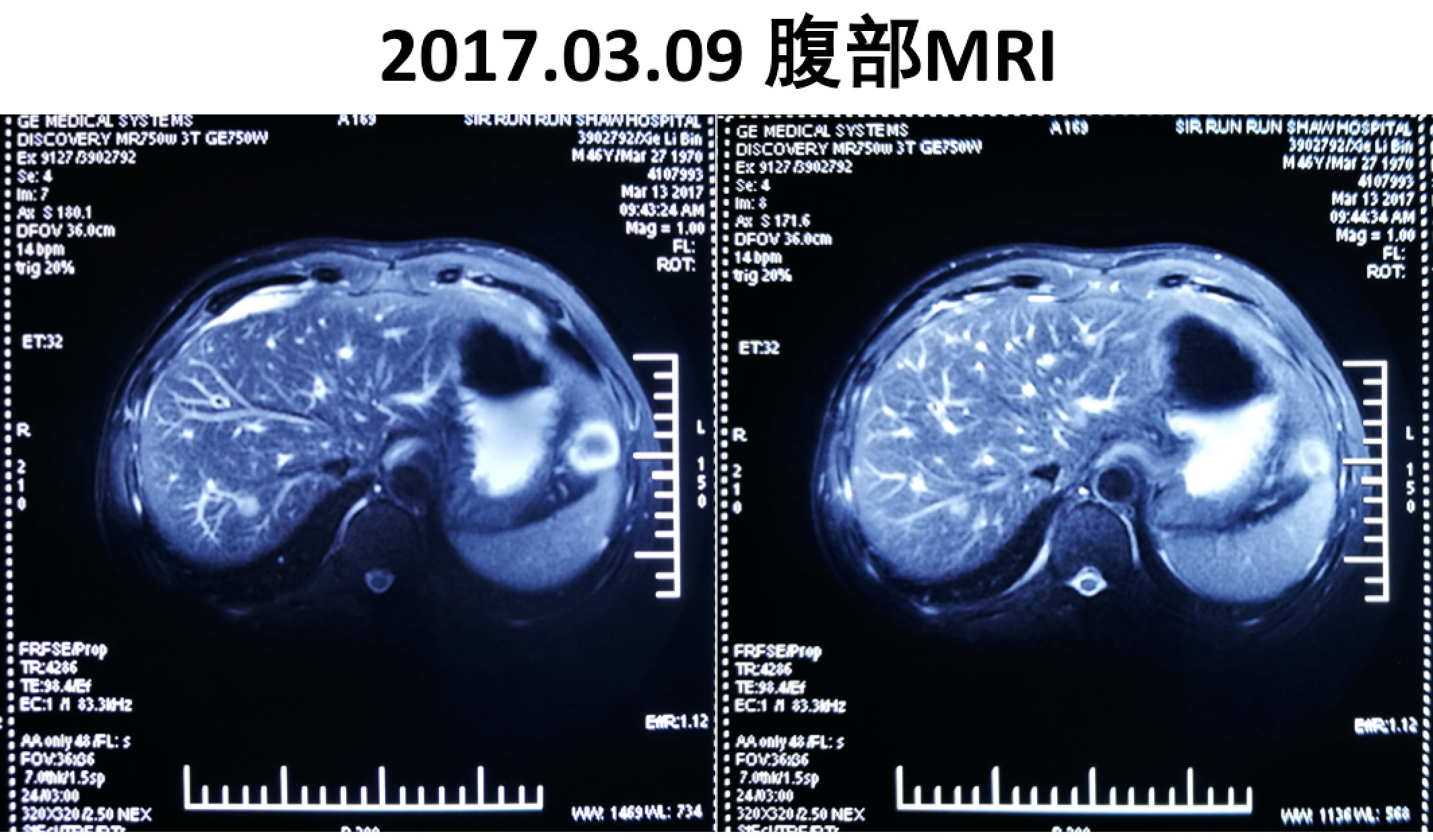 屏幕快照 2017-08-04 上午1.02.35.png