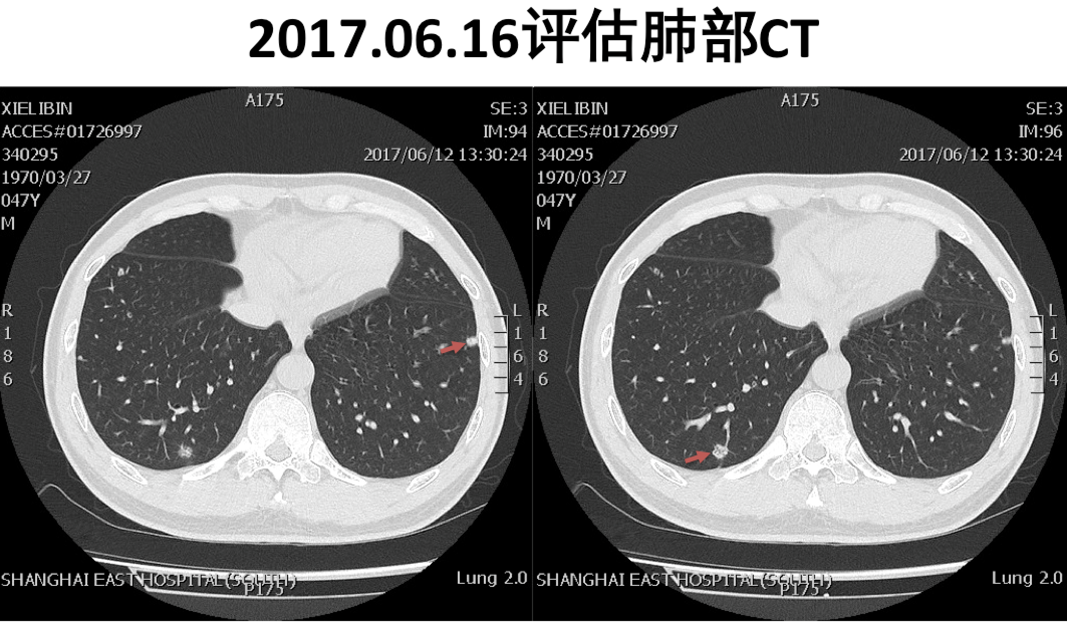 屏幕快照 2017-08-04 上午1.02.51.png