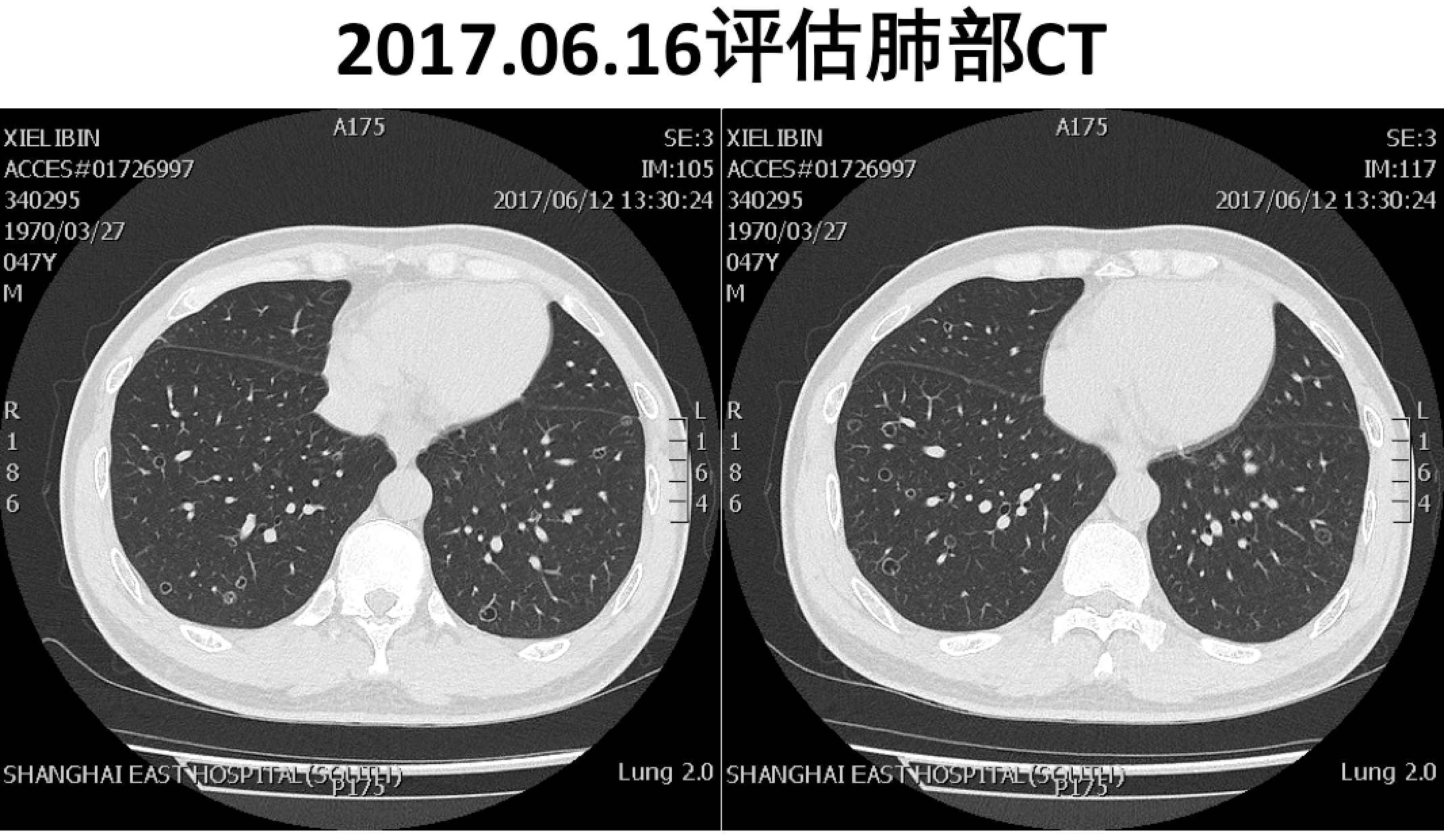 屏幕快照 2017-08-04 上午1.03.11.png