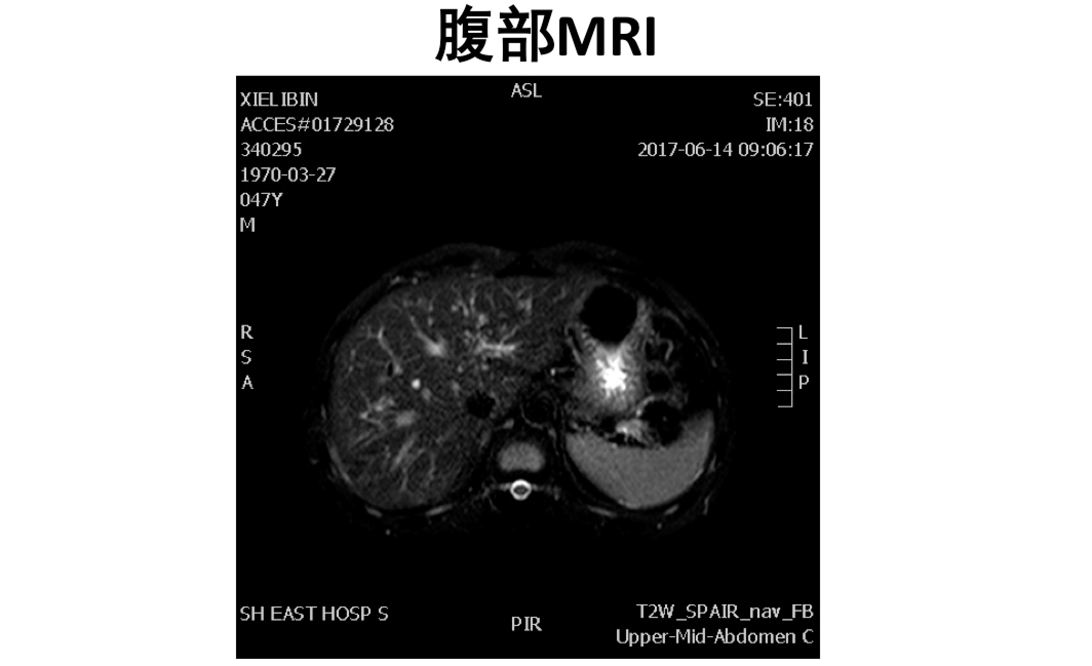 屏幕快照 2017-08-04 上午1.03.23.png