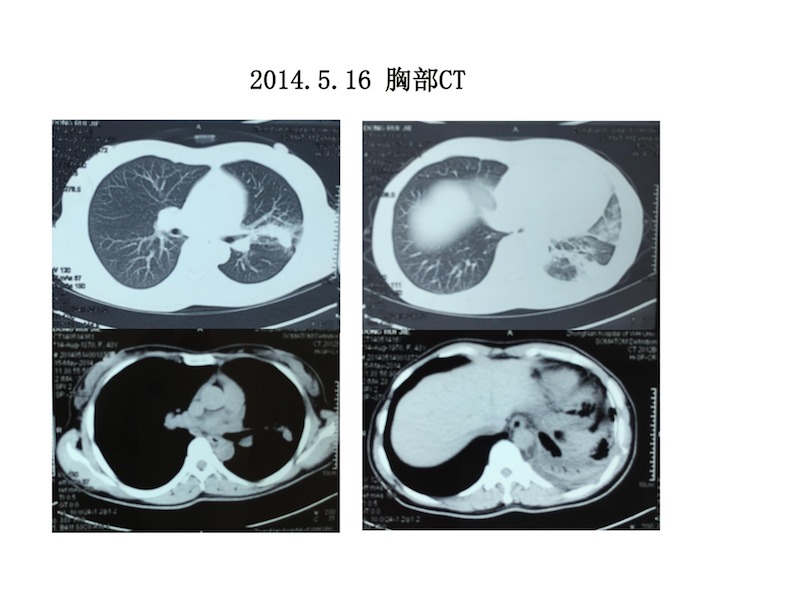 屏幕快照 2017-08-04 上午11.40.57.png