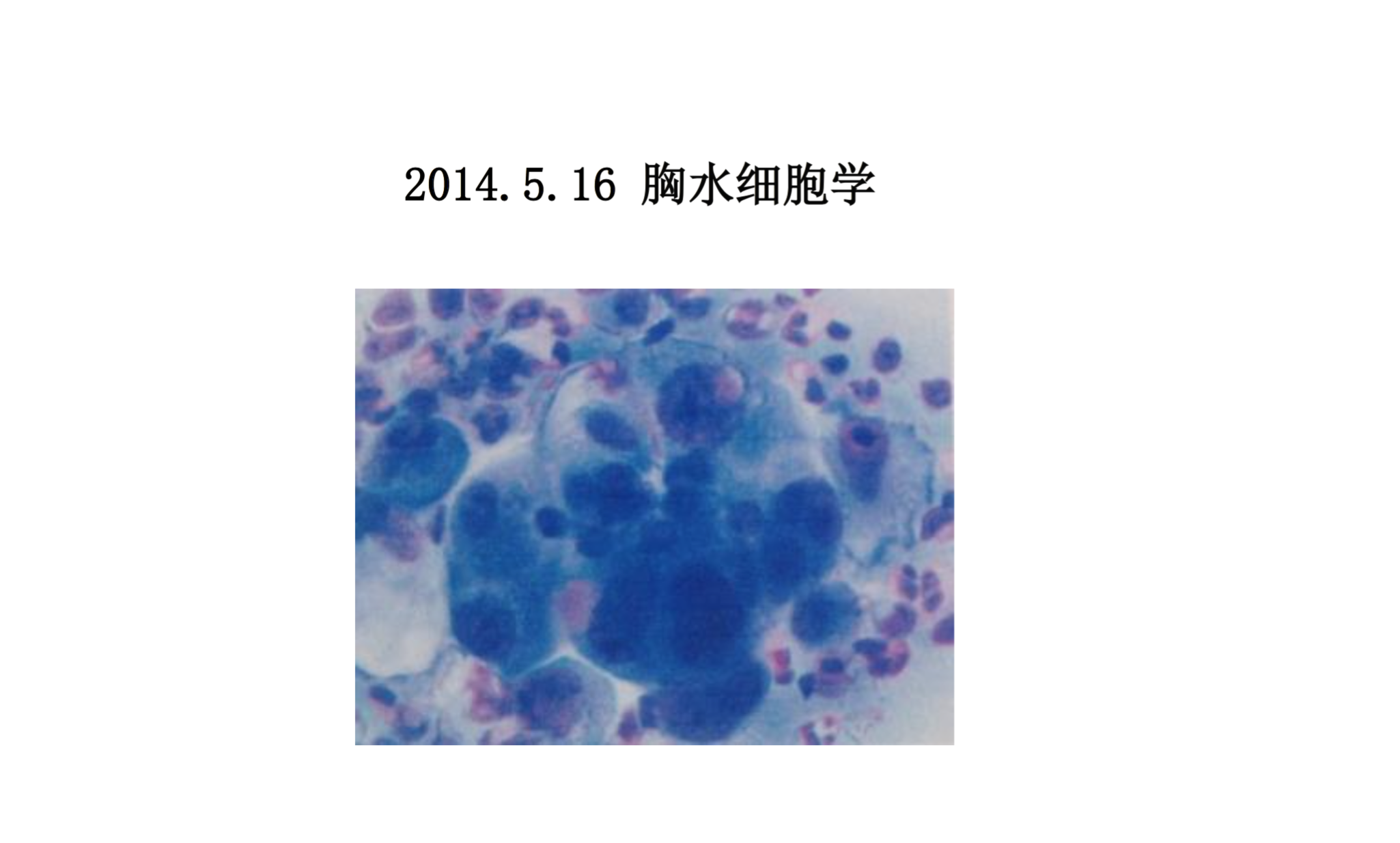 屏幕快照 2017-08-04 上午11.41.05.png