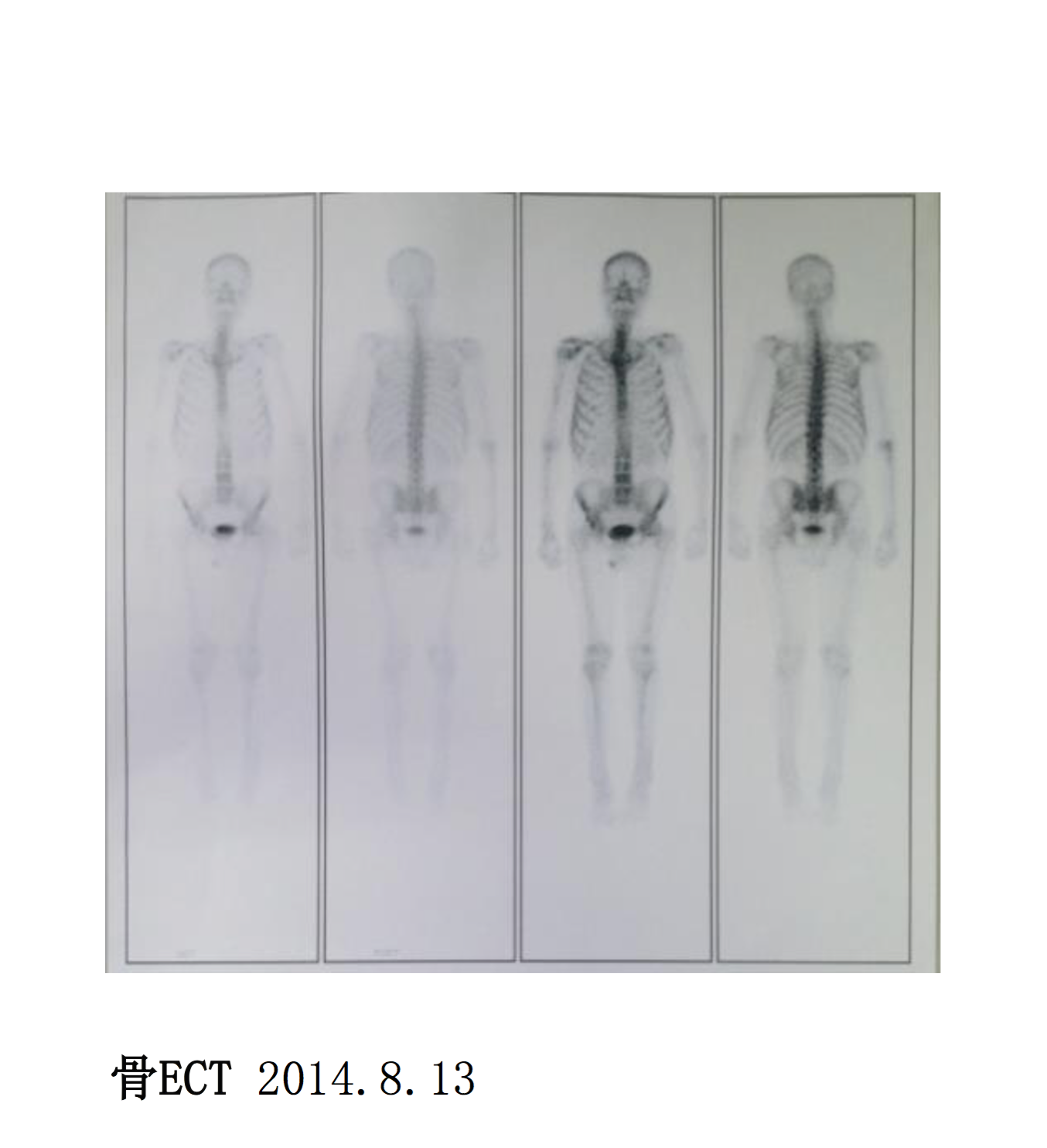 屏幕快照 2017-08-04 上午11.42.03.png
