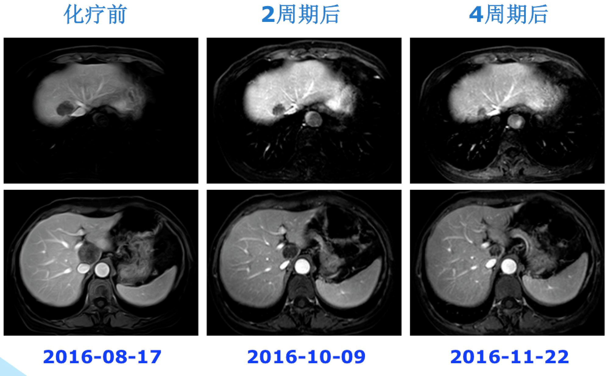 屏幕快照 2017-08-04 下午6.49.27.png