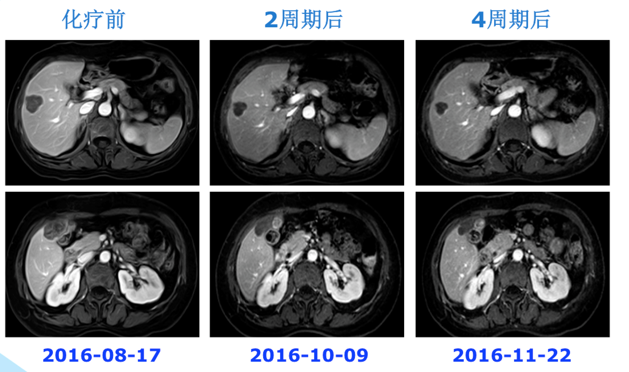 屏幕快照 2017-08-04 下午6.49.37.png