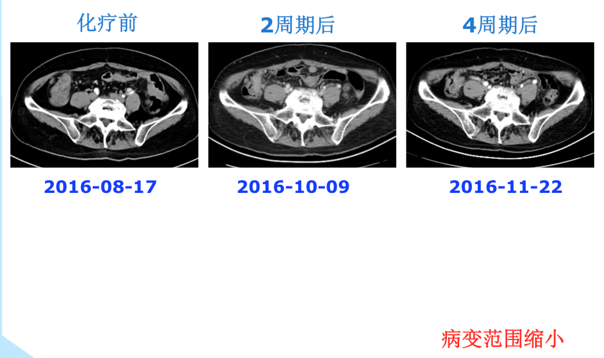 屏幕快照 2017-08-04 下午6.49.48.png