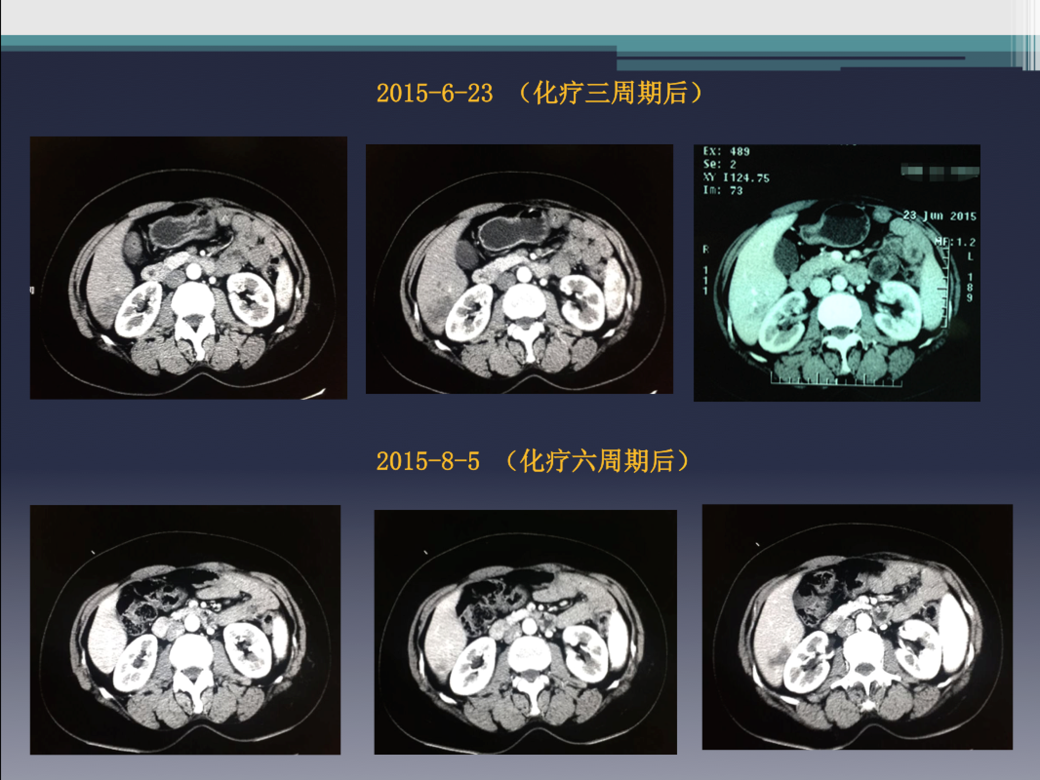 屏幕快照 2017-08-05 下午7.33.15.png