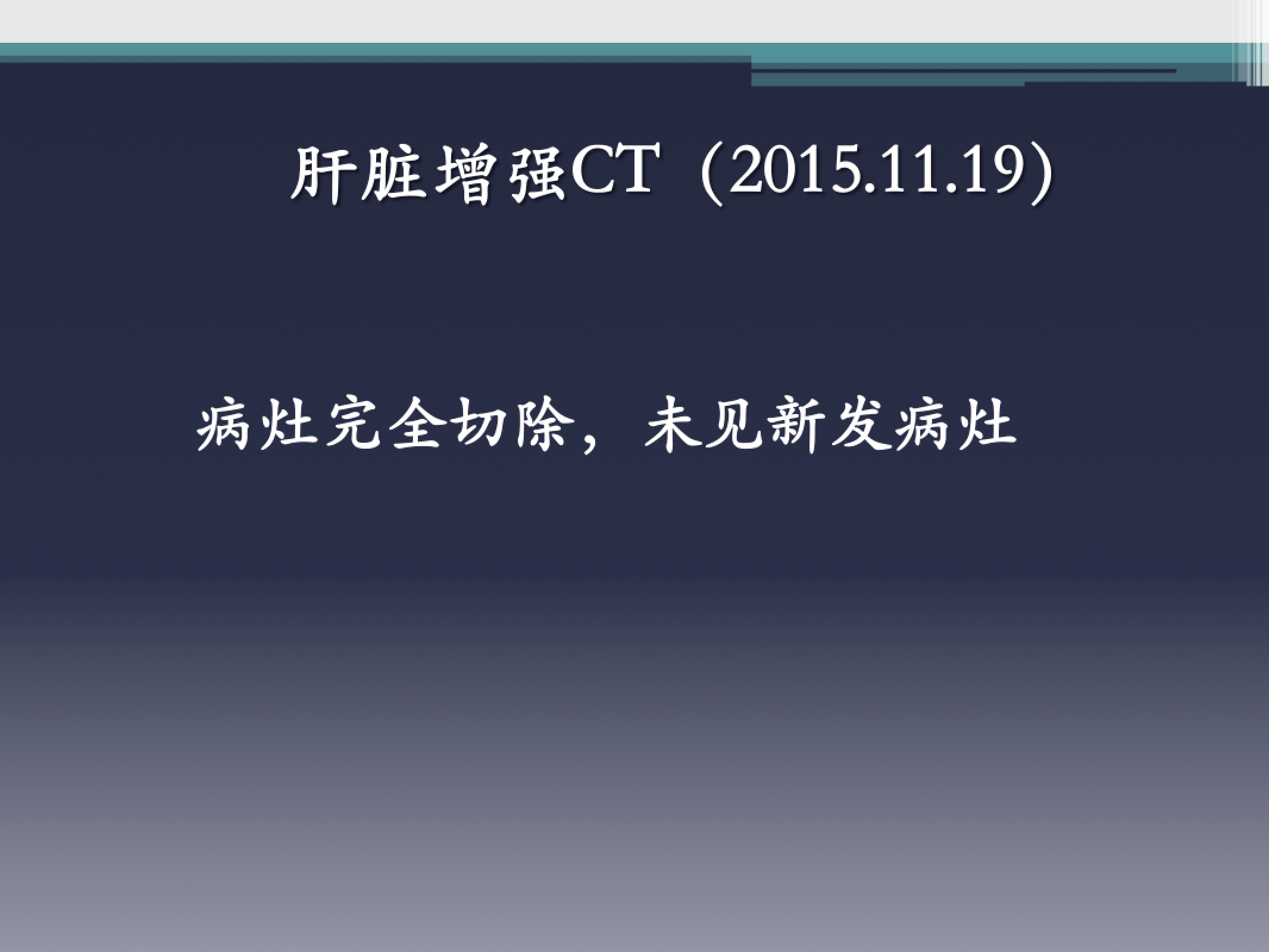 屏幕快照 2017-08-05 下午7.33.50.png