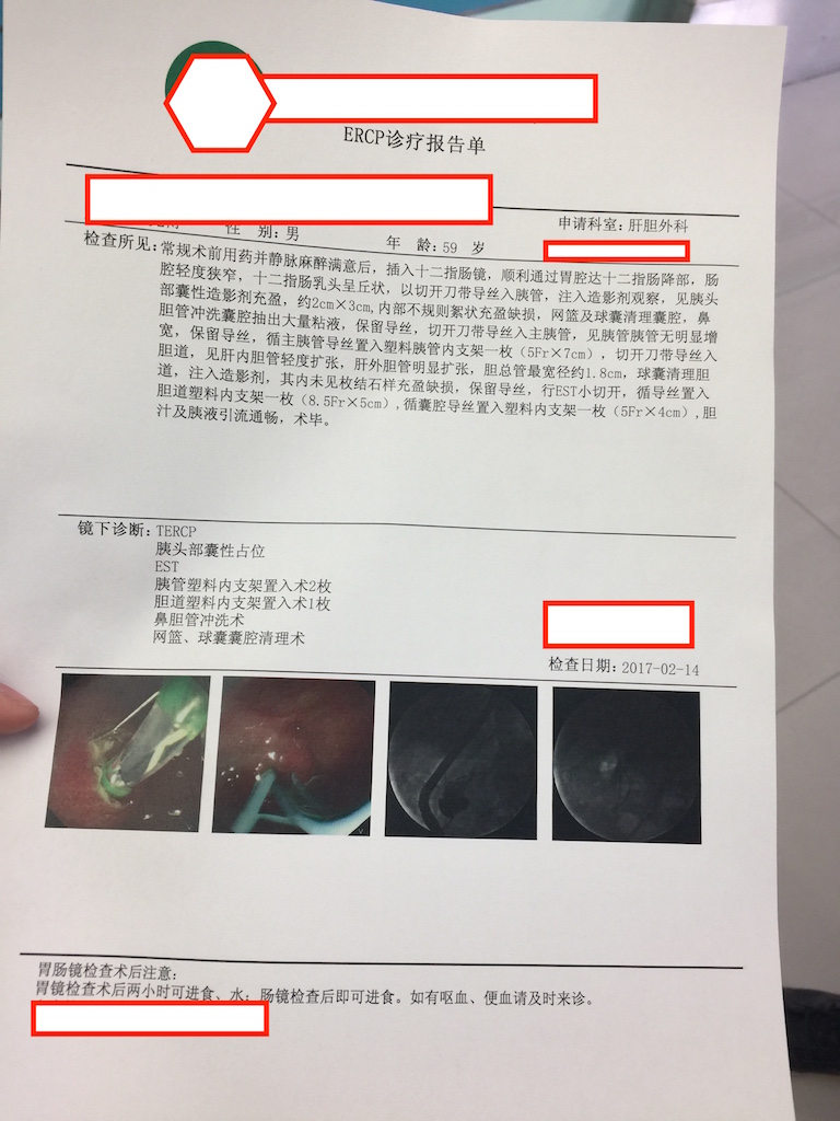 (2:14)ERCP诊疗报告单.jpg