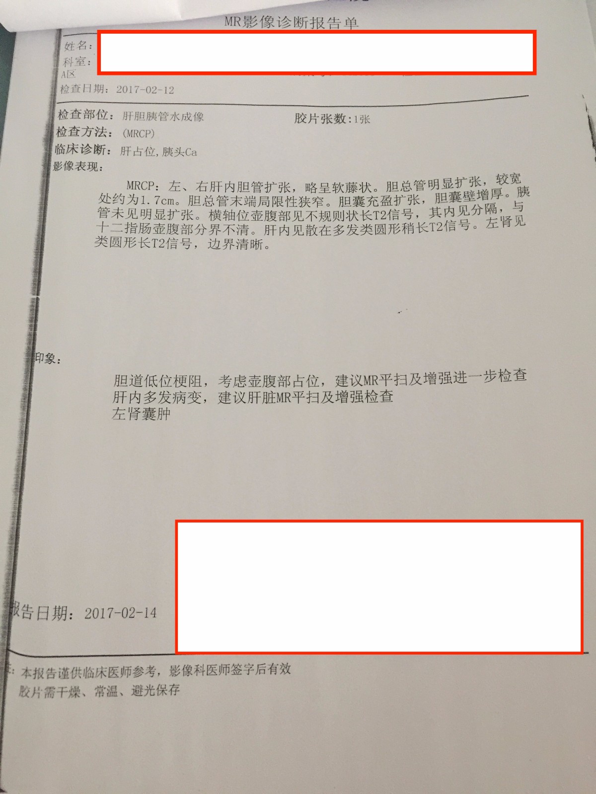 MRCP诊断报告（2-14）.jpg
