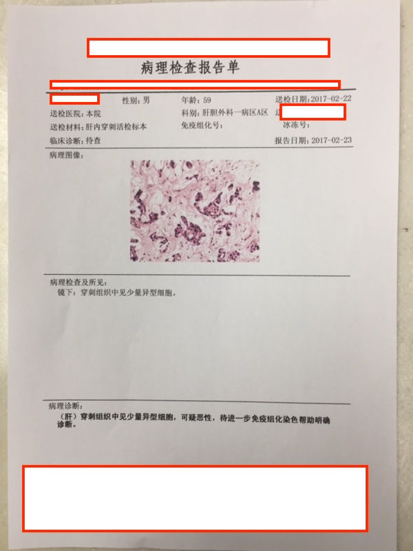 (2:22)病理检查报告单-2.jpg