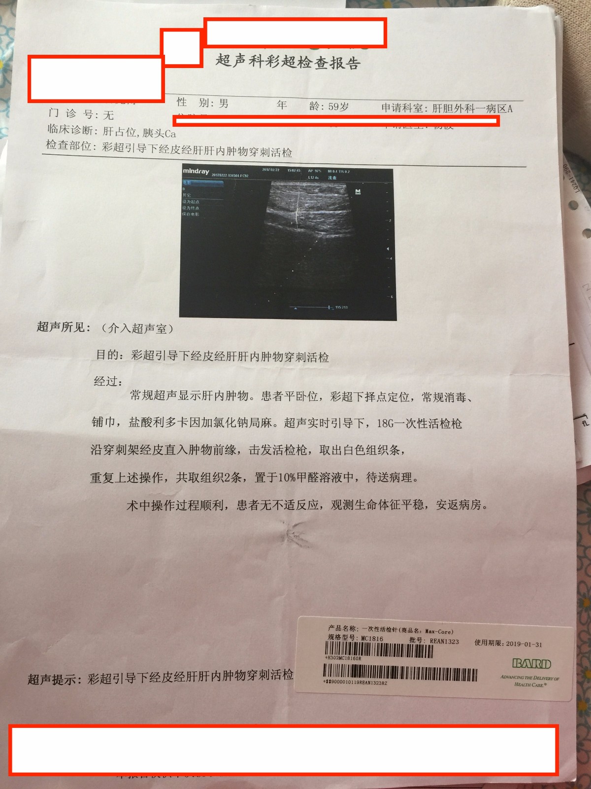 (2:22)彩超检查报告-3.jpg
