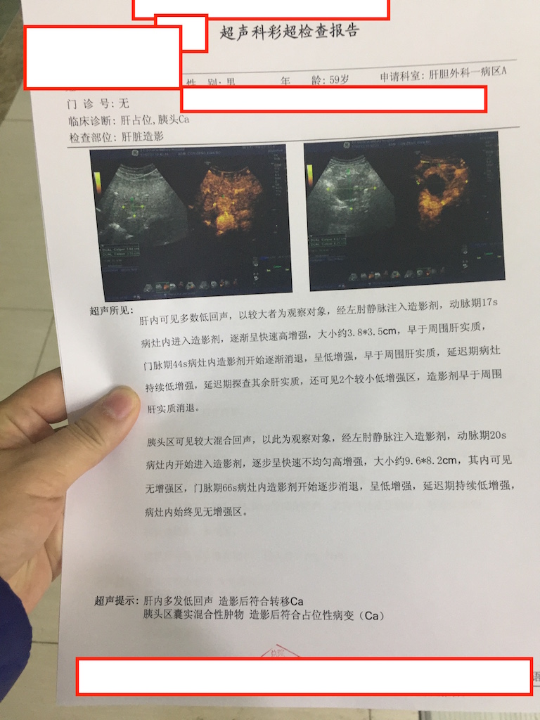 (2:22)肝脏造影.jpg