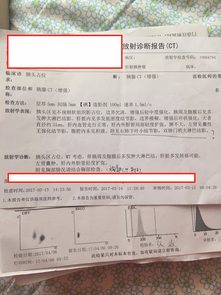 复肿ct报告单（3-14）.jpg