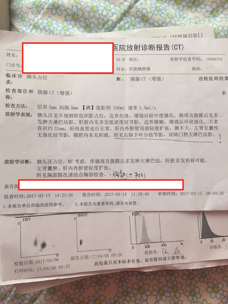 复肿ct报告单2（3-14）.jpg