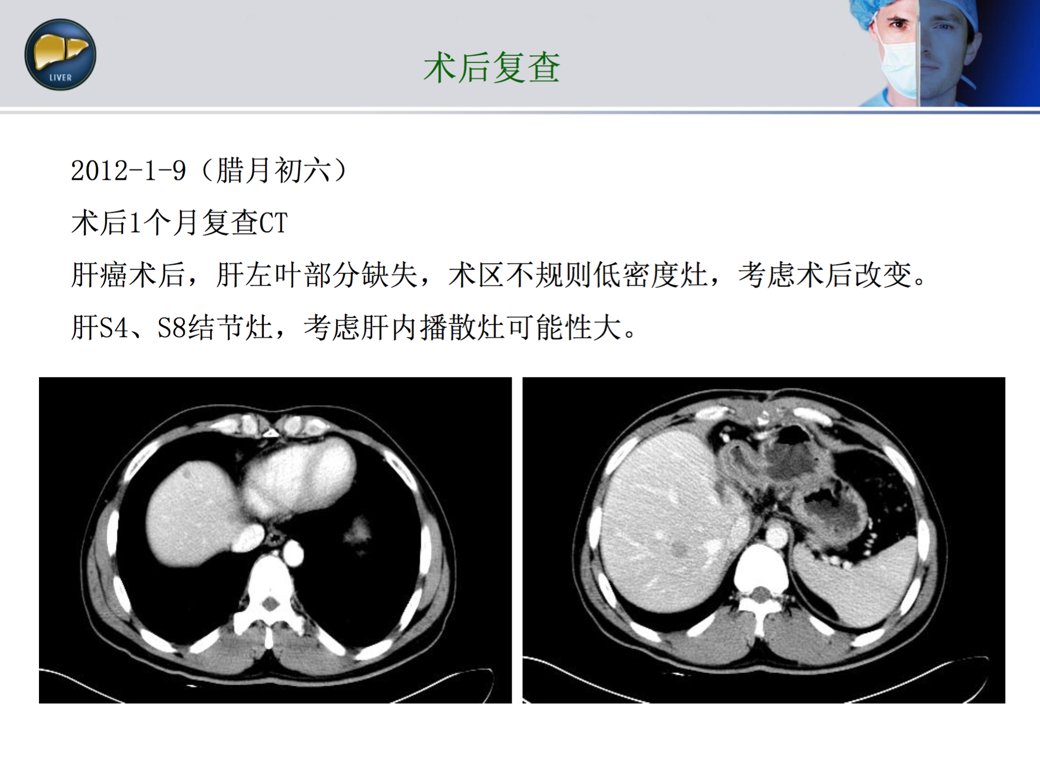 屏幕快照 2017-08-17 上午12.11.13.png