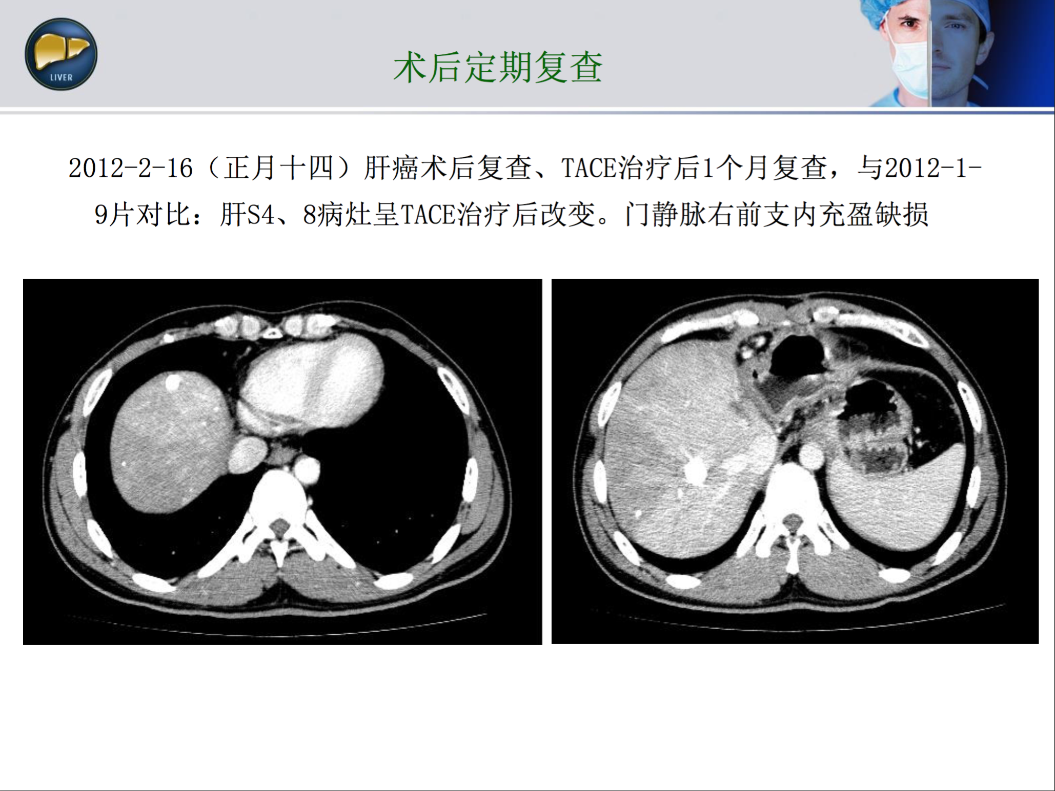 屏幕快照 2017-08-17 上午12.11.50.png