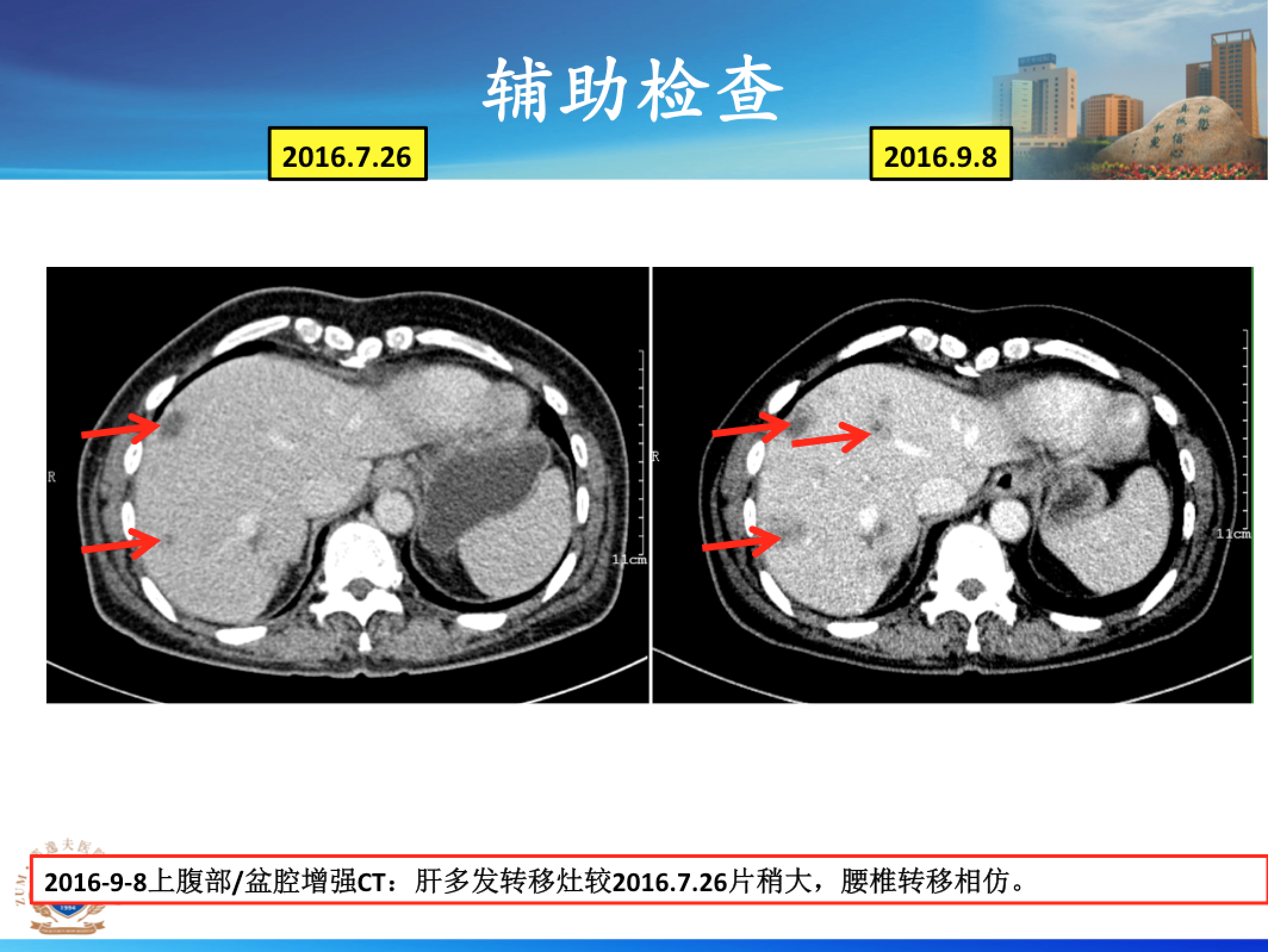 屏幕快照 2017-08-21 上午2.54.05.png