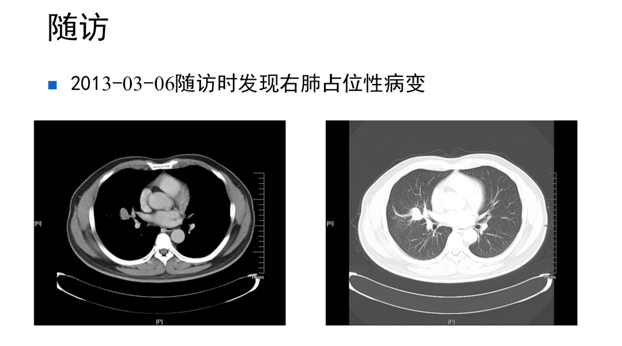 屏幕快照 2017-08-04 下午10.39.18.png