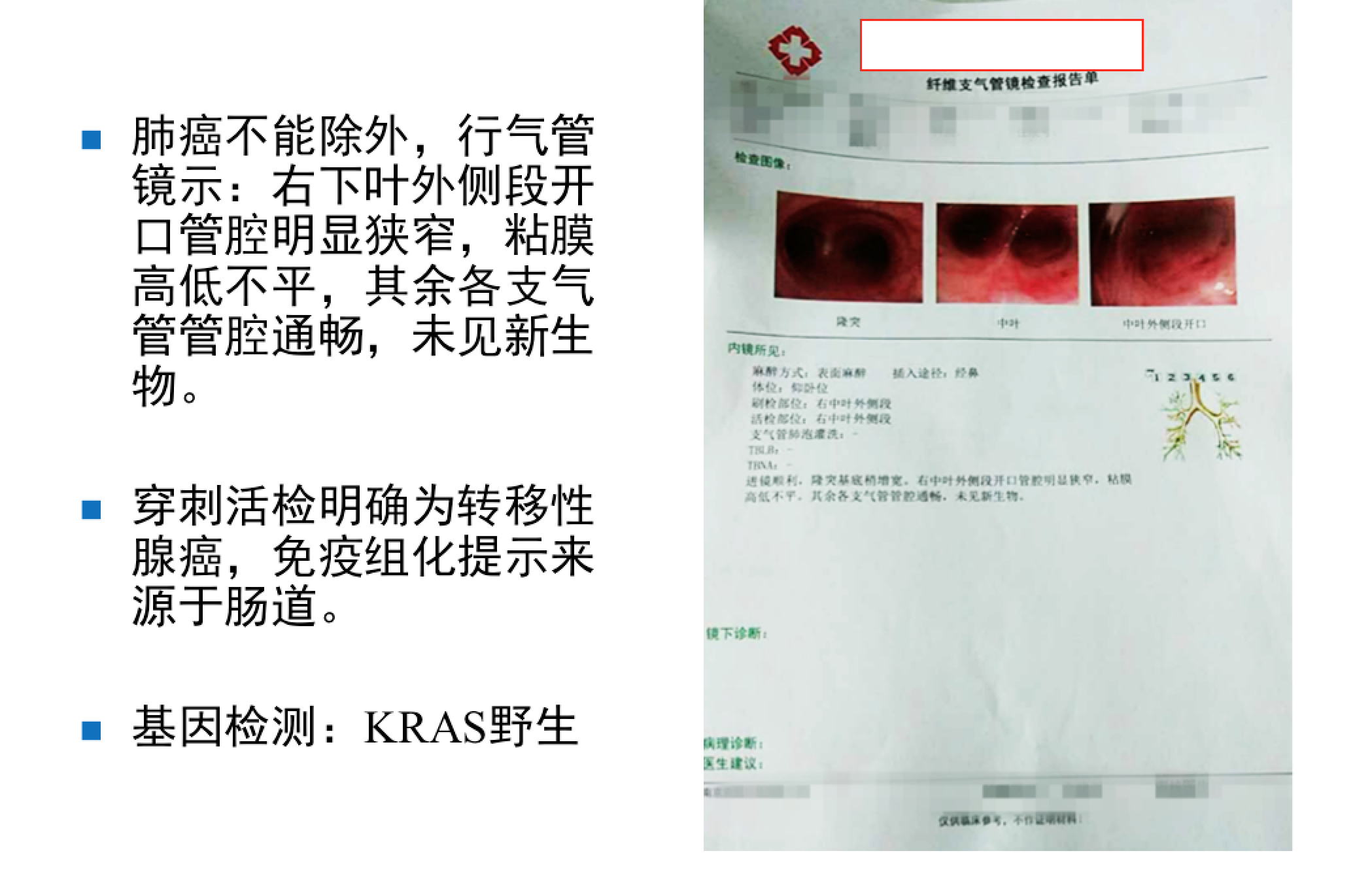 屏幕快照 2017-08-04 下午10.39.28.png