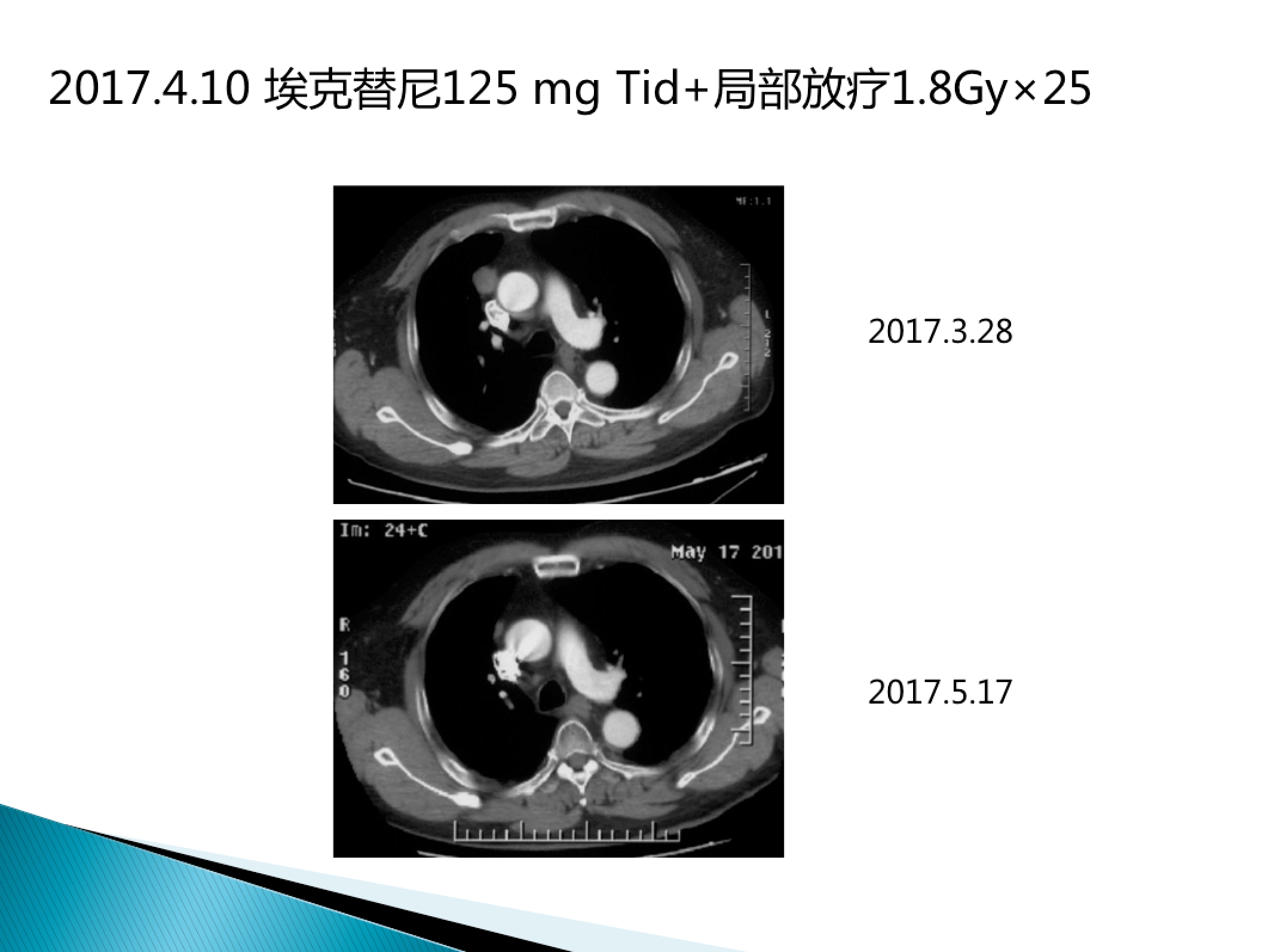 屏幕快照 2017-08-04 下午5.46.13.png