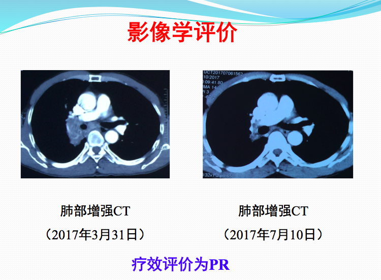 屏幕快照 2017-08-01 下午4.47.30.png
