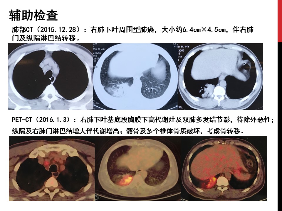 幻灯片3.JPG