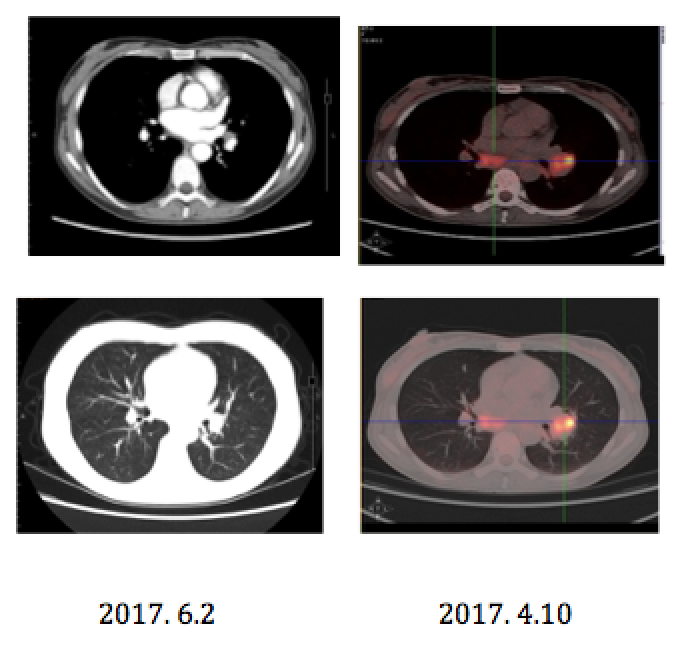 屏幕快照 2017-08-05 下午4.49.21.png