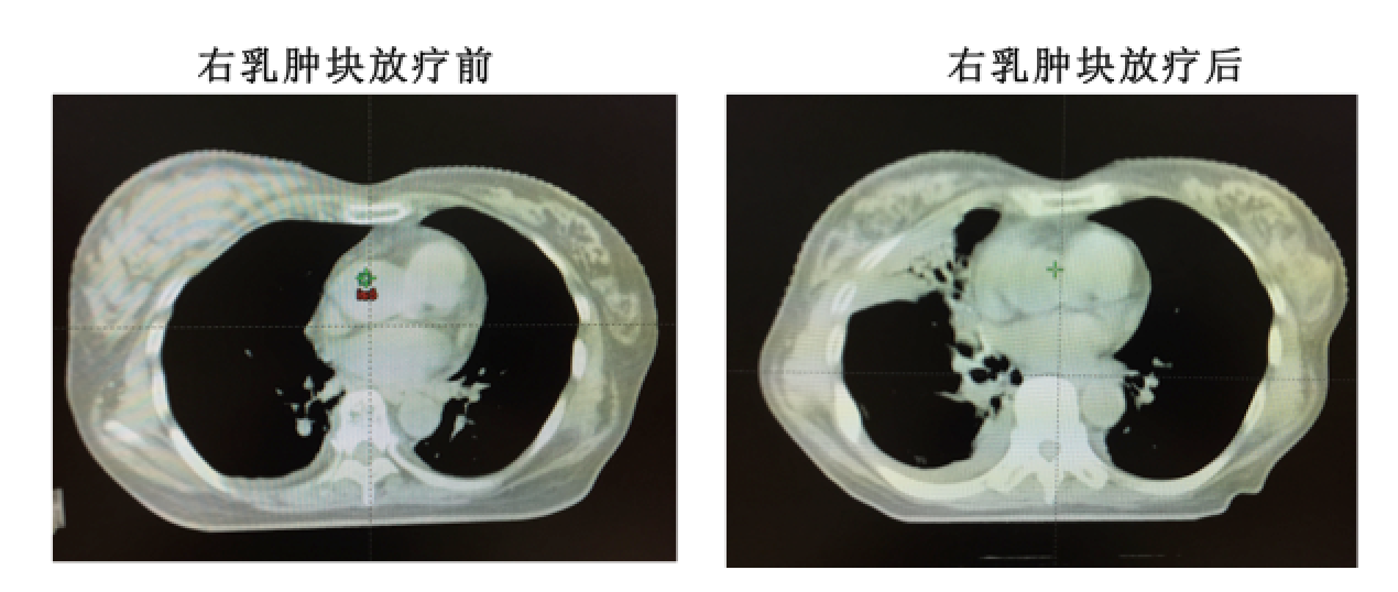 屏幕快照 2017-08-04 下午8.07.14.png
