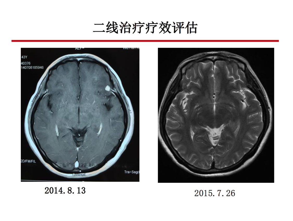 屏幕快照 2017-08-21 下午7.40.32.png