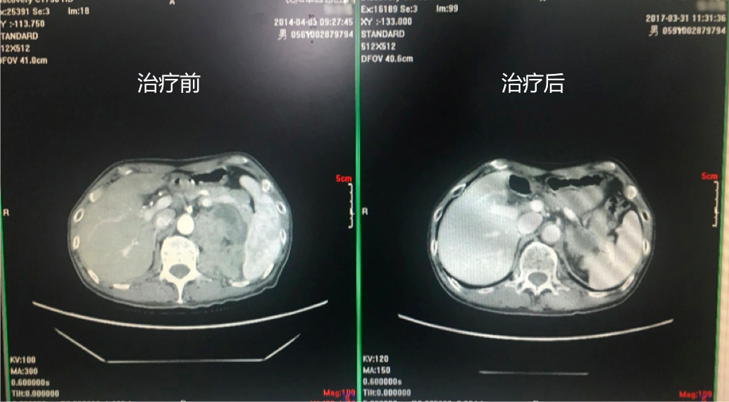 屏幕快照 2017-08-23 上午11.59.48.png