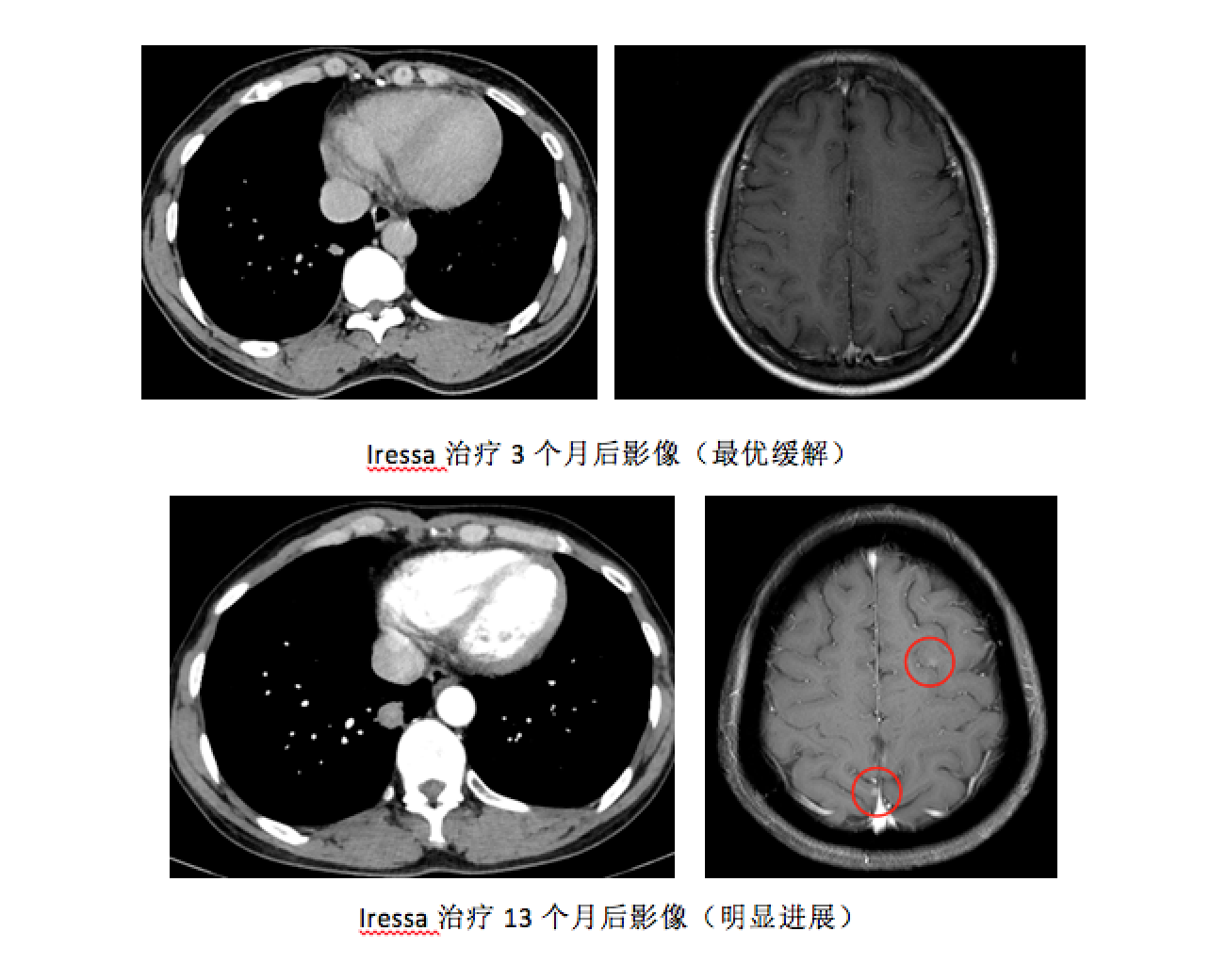 屏幕快照 2017-08-04 下午10.54.58.png