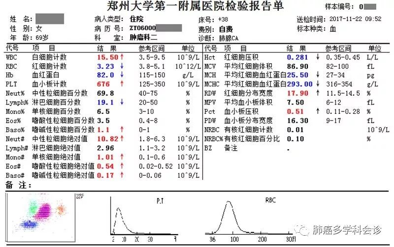 表一.jpg