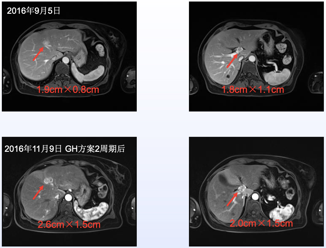 屏幕快照 2019-05-22 下午4.36.32.png