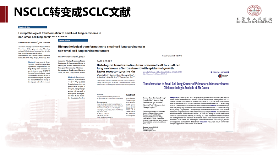 肺癌多学科诊治病例-刘克军_28.png