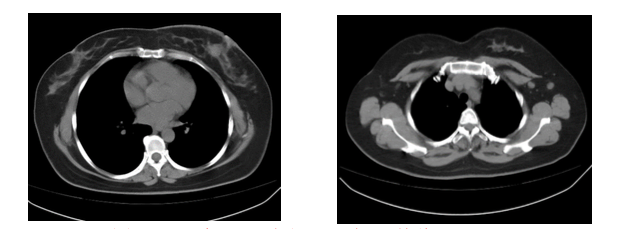 屏幕快照 2019-12-27 下午1.37.32.png
