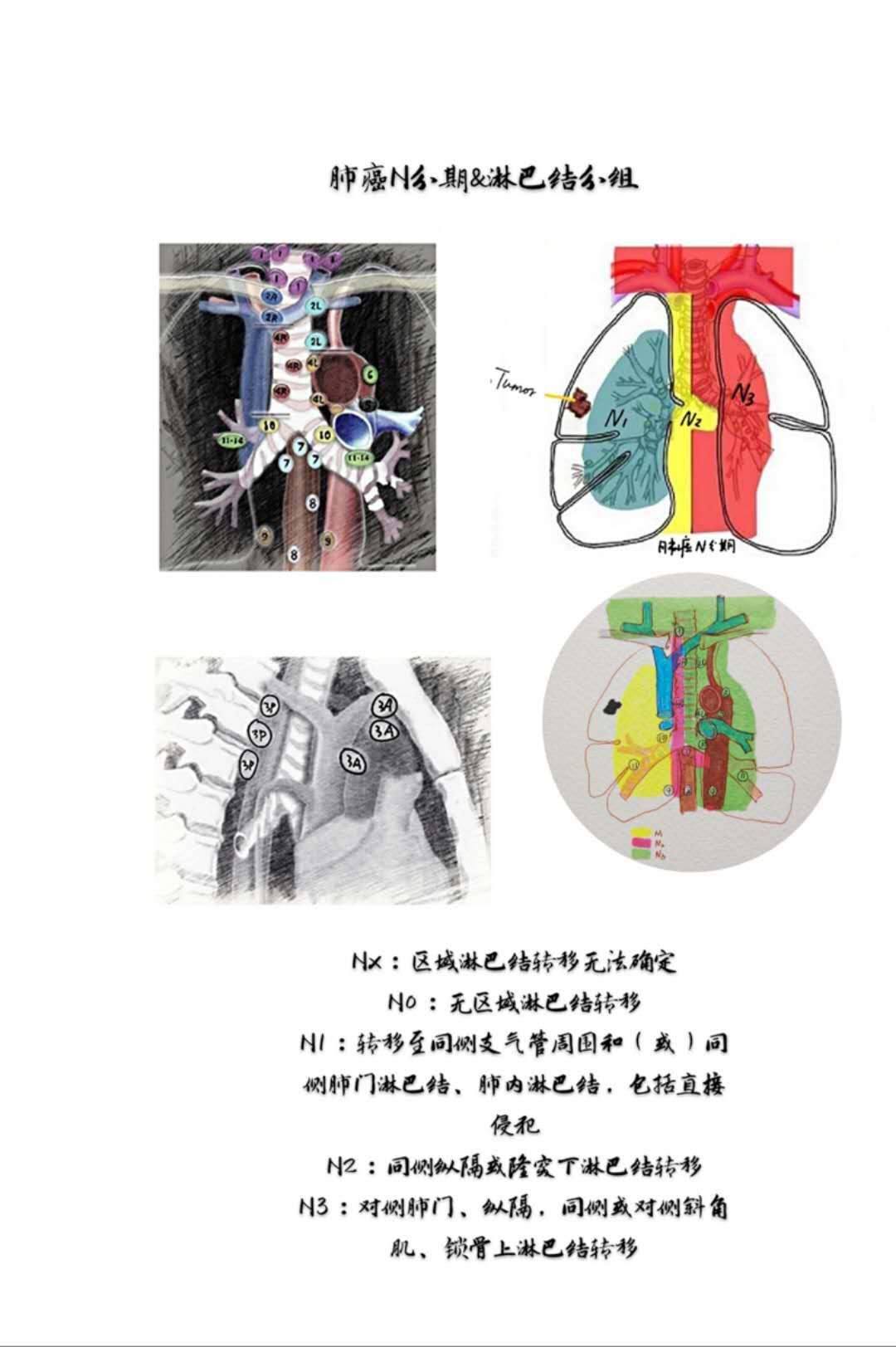 肺癌1.jpg